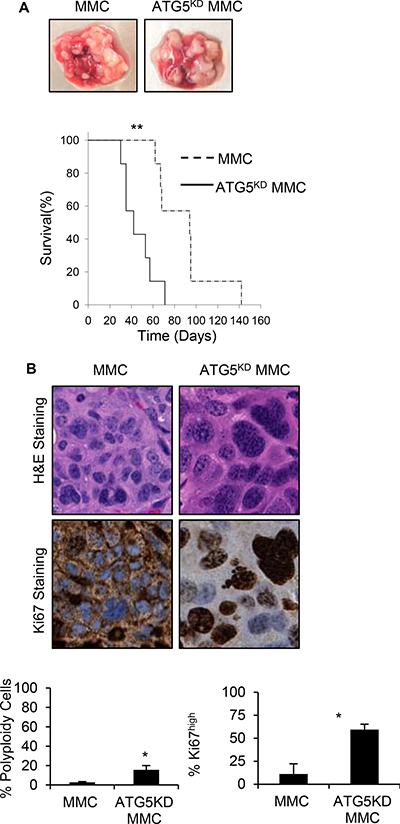 Earlier relapse of autophagy knockdown tumor cells with polyploid morphology compared with autophagy competent tumor cells, in vivo.