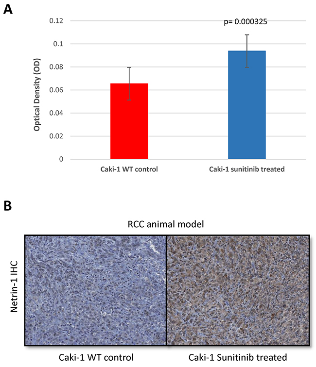 NTN1 upregulation in RCC animal model after resistance to sunitinib.