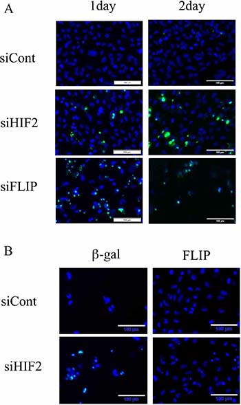 Knockdown of c-FLIP induces apoptosis and its introduction averts apoptotic cell death in the starvation-resistant RCC cell line SW839.