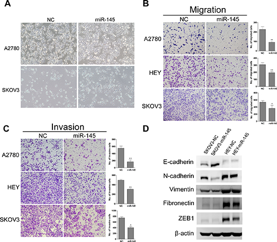 Ectopic expression of miR-145 suppresses ovarian cancer cell migration and invasion in vitro and induced mesenchymal to epithelial transformation(MET).