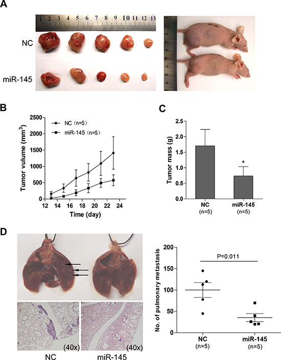 miR-145 overexpression inhibits tumor growth and metastasis in a xenograft model.