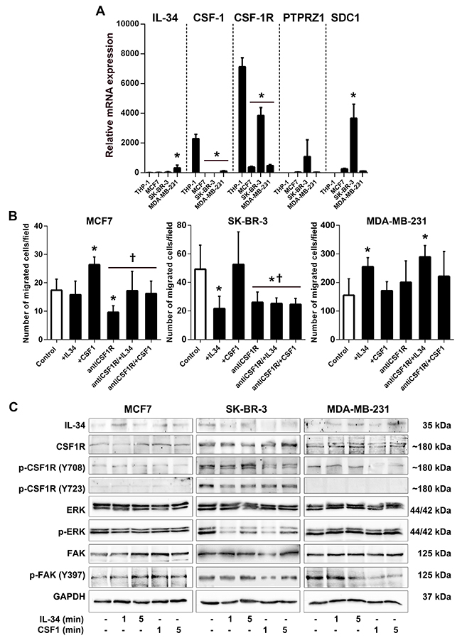 IL-34 differentially regulates migration and signaling of human breast cancer cell lines.