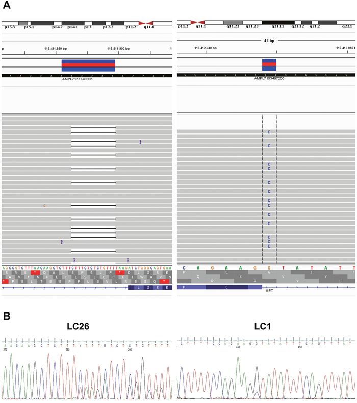 Genomic alterations that promote MET exon 14 skipping in NSCLC.