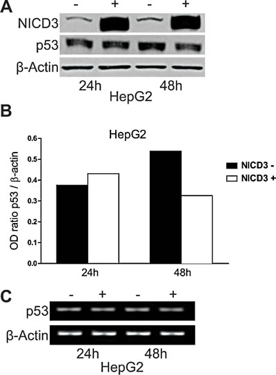 Effects of Notch3 over-expression on p53 levels.