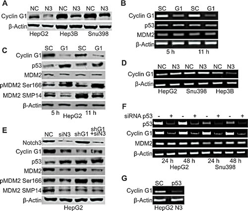 Cyclin G1 regulates p53 accumulation in Notch3 depleted cells.