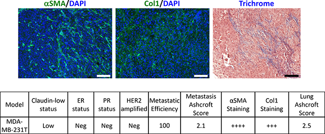 Analysis of fibrosis in metastatic lung tissue from human MDA-MB-231T cells.