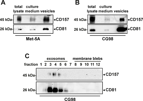 Analysis of CD157 expression in vesicles released by mesothelial cells.