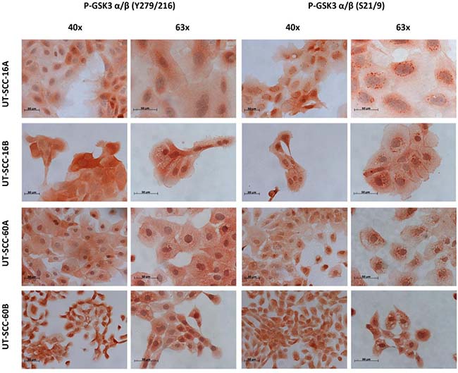 Immunohistochemical staining of p-GSK3&#x03B1;/&#x03B2; (Ser21/9) and p-GSK3&#x03B1;/&#x03B2; (Ser21/9) in permanent HNSCC cell lines.