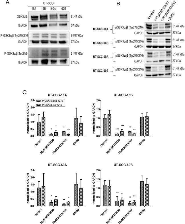 Decreased GSK3 activity in response to SB 216763.