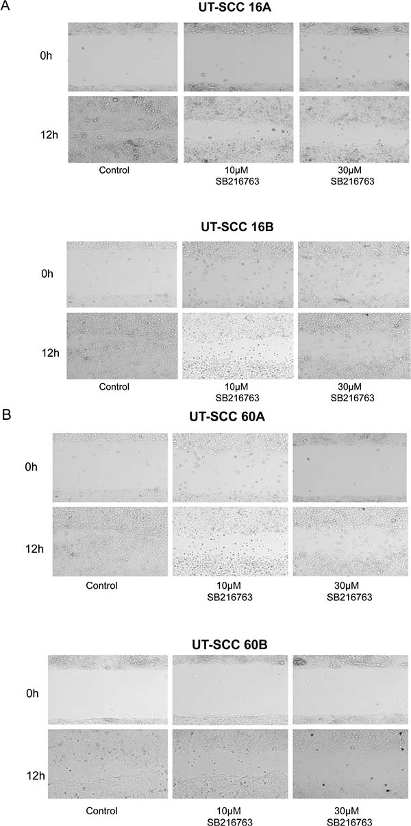 Scratch assay of permanent HNSCC cell lines after SB 216763 treatment.