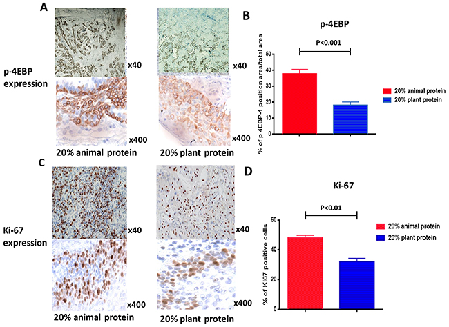 Immuno-histochemical staining for p-4EBP1 and Ki67 in tumors.