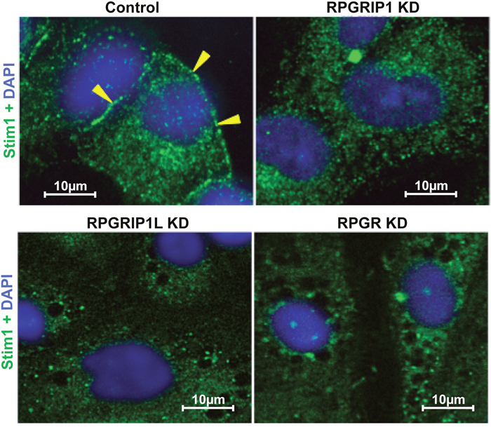 Defect in STIM1 localization to the ER-PM junction in knockdown (KD) cells.