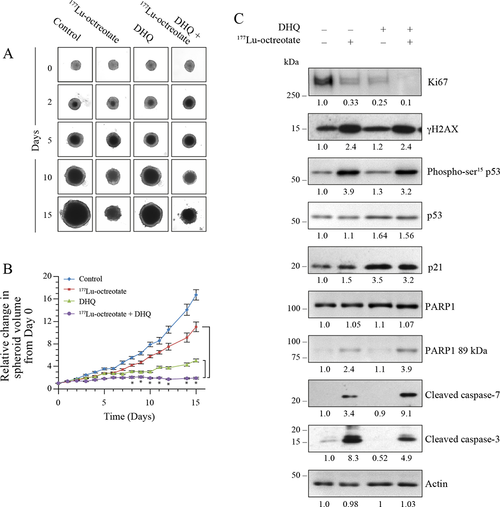 Effect of 177Lu-octreotate and PARPi on BON-1 spheroids.