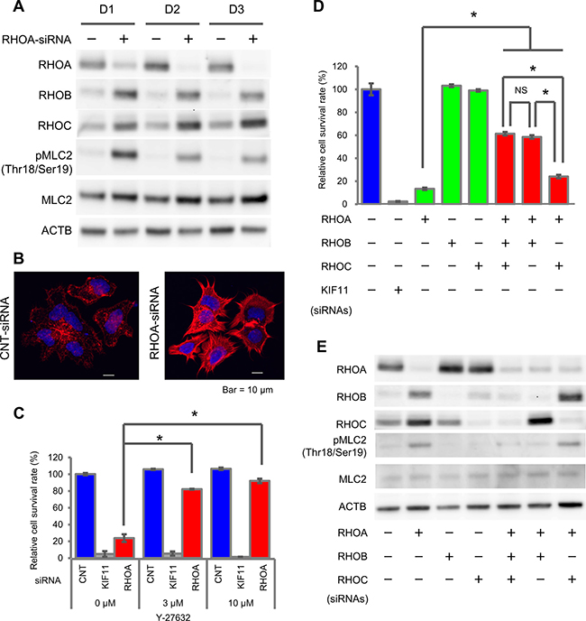 Activation of ROCK signaling by RHOA knockdown in SW948.