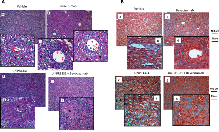 In vivo VM and angiogenesis from U87MG tumors.