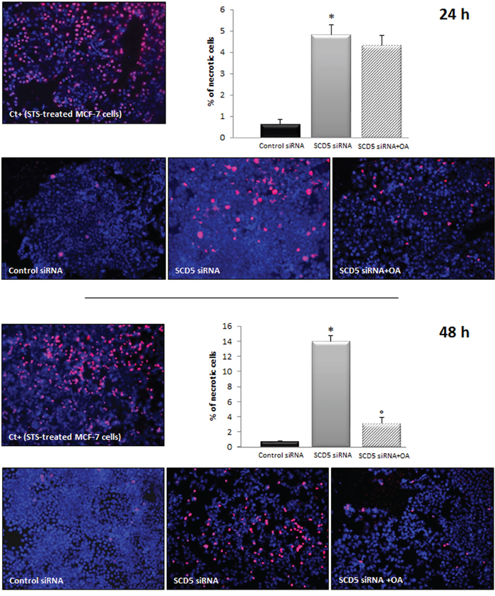 Oleic acid rescues MCF-7 cells from necrotic cell death induced by SCD5 knockdown.