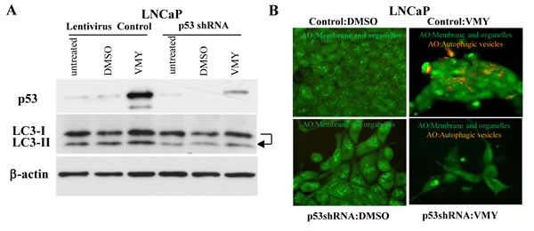 Genetic silencing of p53 inhibits the autophagic response to VMY.