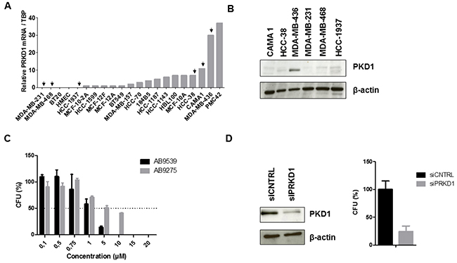 Effect of PKD1 inhibition in TNBC cells.