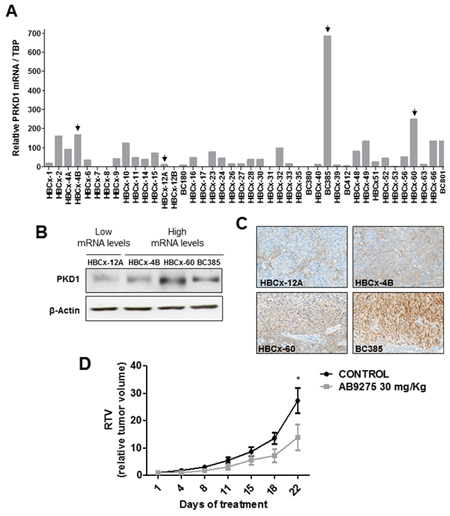 In vivo antitumor activity of the AB9275 PKD1 inhibitor against a TNBC PDX.