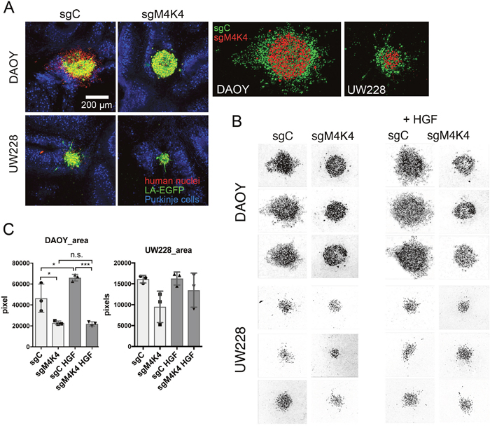 MAP4K4 promotes brain tissue infiltration.