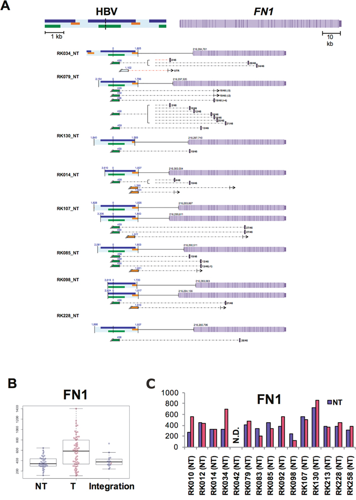 Influence of HBV integrations on FN1 in NT samples.