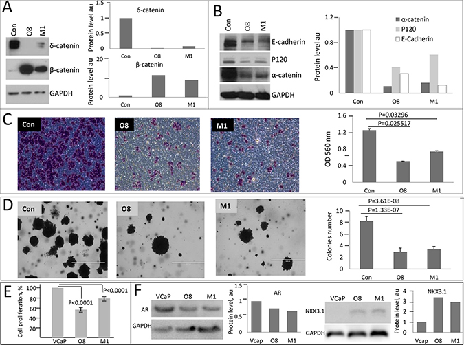Oncogenic properties of PCa cells diminish upon knockdown of &#x03B4;-catenin.