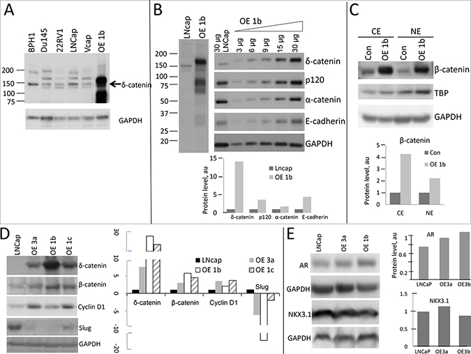 Activation of &#x03B2;-catenin pathway in LNCaP cells overexpressing &#x03B4;-catenin.