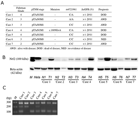 Expression of Nrf2 and genotyping of rs6721961 SNP.