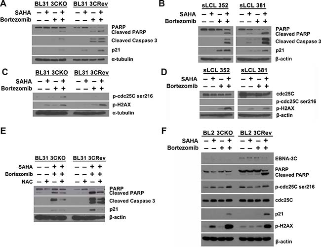 Effects of SAHA/bortezomib on the expression of cellular molecules related to EBNA3C signaling.