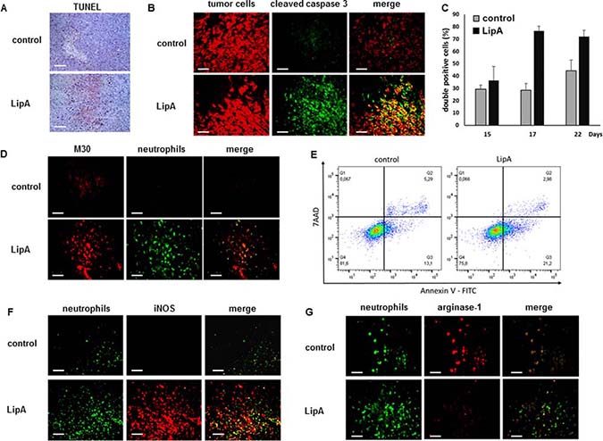LipA treatment induced tumor cell death in the vicinity of infiltrated anti-tumorigenic neutrophils.
