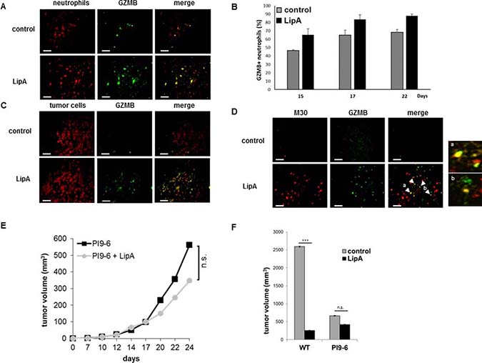Granzyme B was present in neutrophils and apoptotic tumor cells in LipA treated rats.