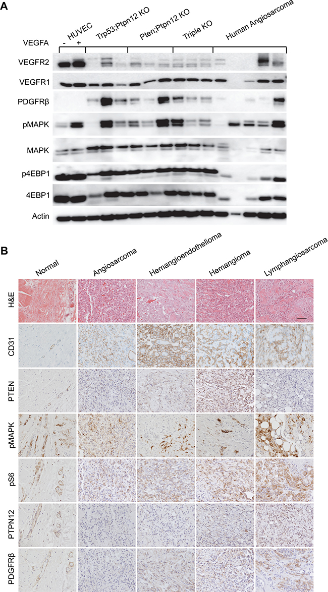 Murine angiosarcomas closely mimic human disease.