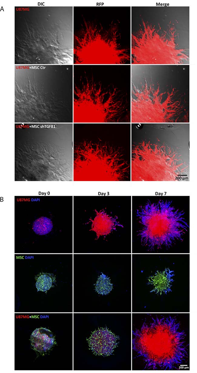 Detailed analysis of arboreal protrusions formed by cells invading the surrounding hydrogel matrix.