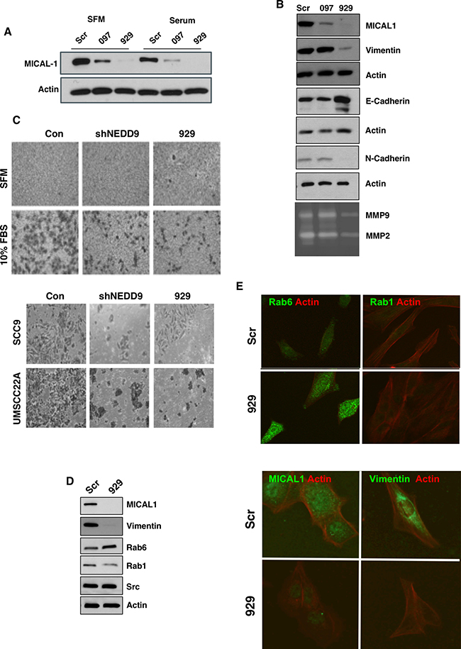 MICAL1 knockdown reduces cell invasiveness and reduced MMP9 secretion.