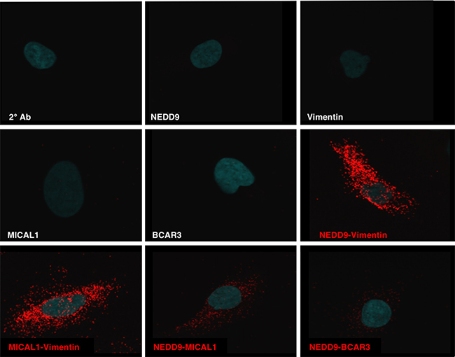 NEDD9 interactions defined by Proximity Ligation Assay.