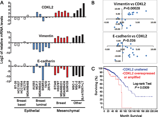 CDKL2 expression in human breast cancer cell lines and human invasive breast cancers.