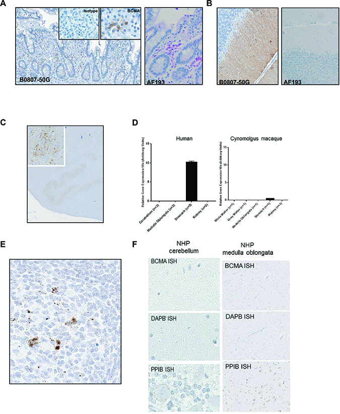 Immunohistochemical staining with two commercially available anti-BCMA antibodies show disparate staining within the brain.