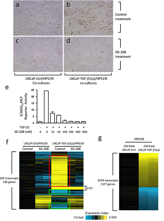 Prostate stromal TGF-&#x03B2; signaling induces profound changes in the co-cultured LNCaP cells.