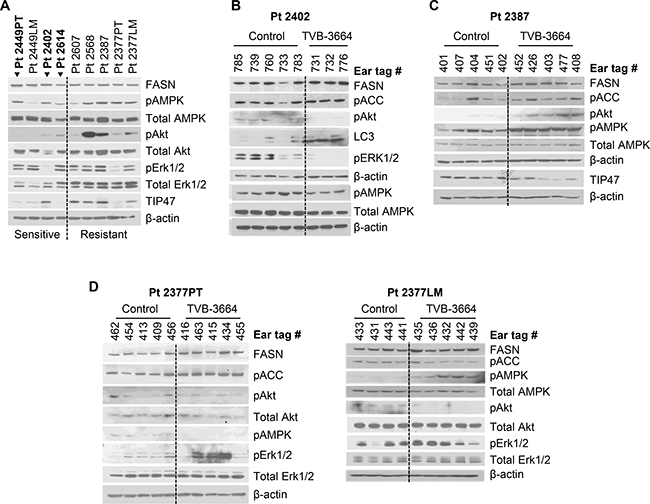 Expression of FASN and activation of FASN-associated oncogenic pathways in PDX models.