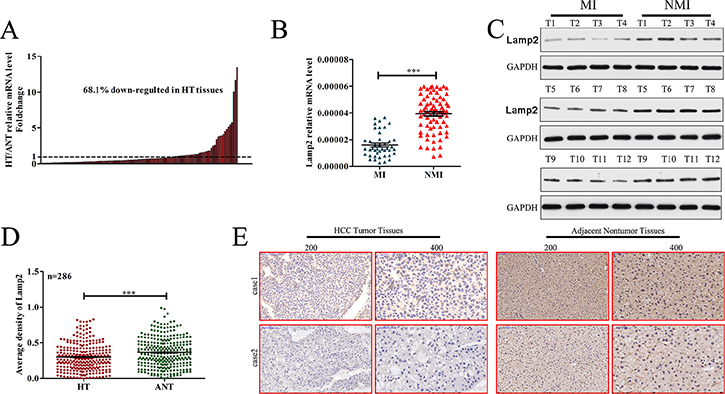 Lamp2 expression is frequently decreased in human HCC tissues.
