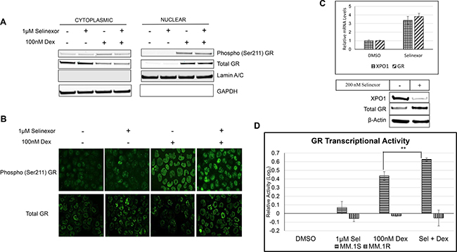 SEL-DEX results in a synergistic increase in GR transcriptional activity.