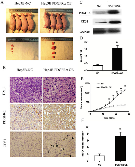 PDGFR&#x03B1; overexpression (OE) promotes tumor growth and progression in vivo.