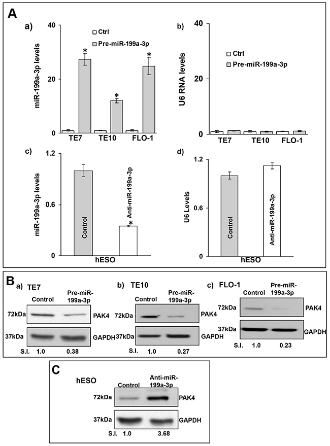 MiR-199a-3p reduces PAK4 expression in human esophageal cells.