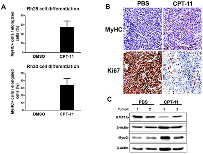 CPT-11 treatment permits differentiation of aRMS cells in vitro and in vivo.