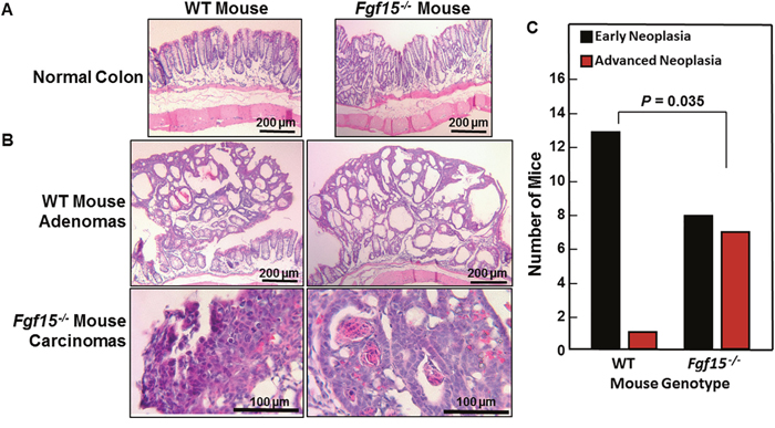 Advanced colon neoplasia in FGF15-deficient mice.