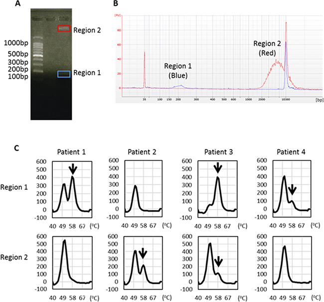 EGFR L858R detection from distinct sizes of plasma DNA isolated from regions 1 and 2.
