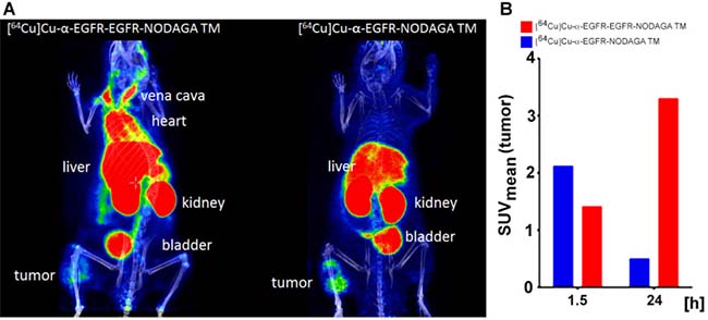 Small animal PET analysis of selected A431-Luc tumor bearing mice after single intravenous injection of the [64Cu]Cu-&#x03B1;-EGFR-EGFR-NODAGA TM- or the [64Cu]Cu-&#x03B1;-EGFR-NODAGA TM complex.