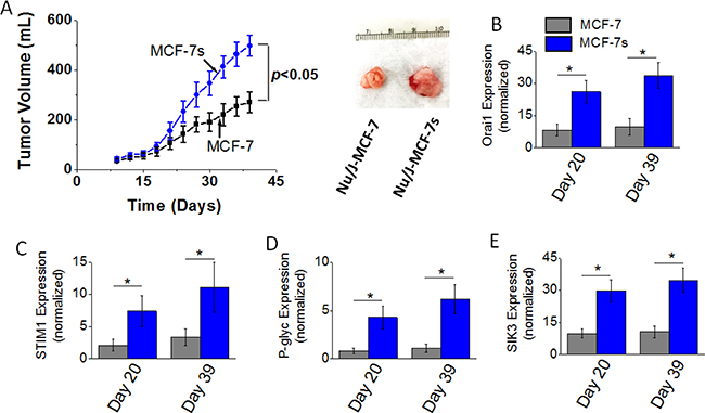 Tumorigenicity of MCF-7 and MCF-7s breast cancer cells.