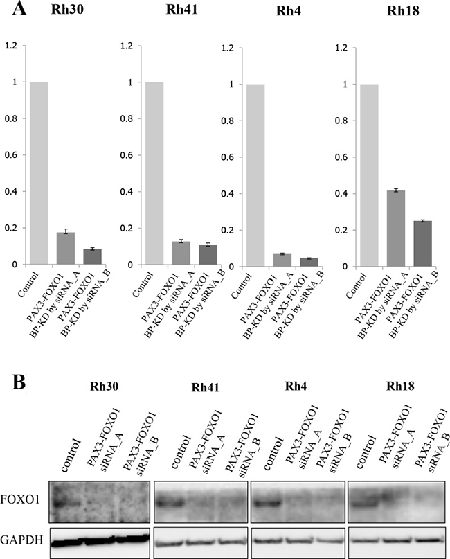 The expression of PAX3-FOXO1 and siRNA targeting PAX3-FOXO1 in ARMS cell lines.