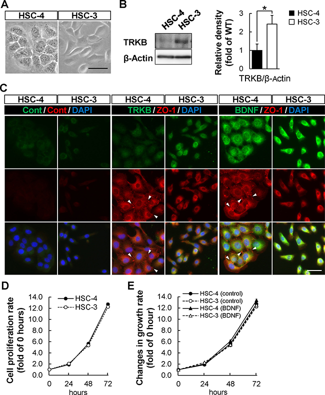 Higher expression of TRKB in HSC-3 poorly differentiated OSCC cell line.